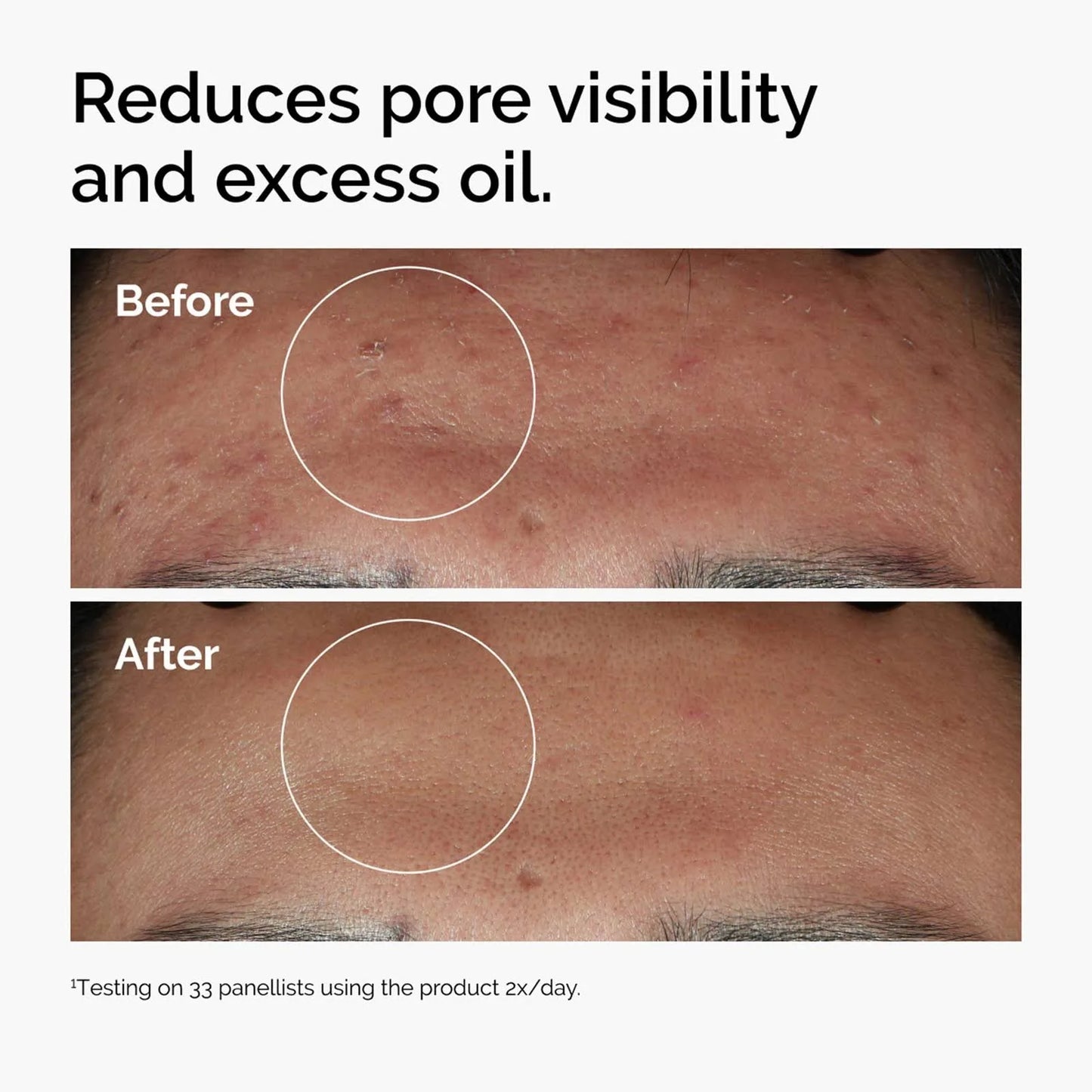 The Ordinary Niacinamide Serum 30ml