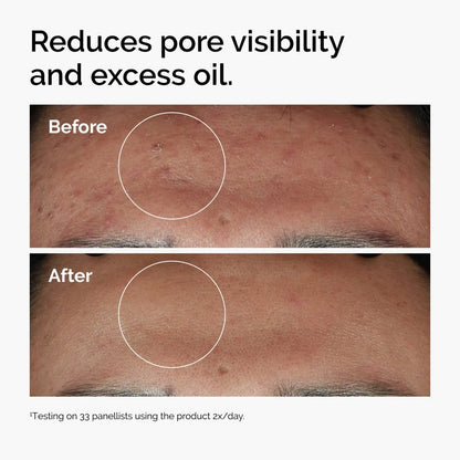 The Ordinary Niacinamide Serum 30ml